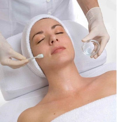 Kemisk peeling